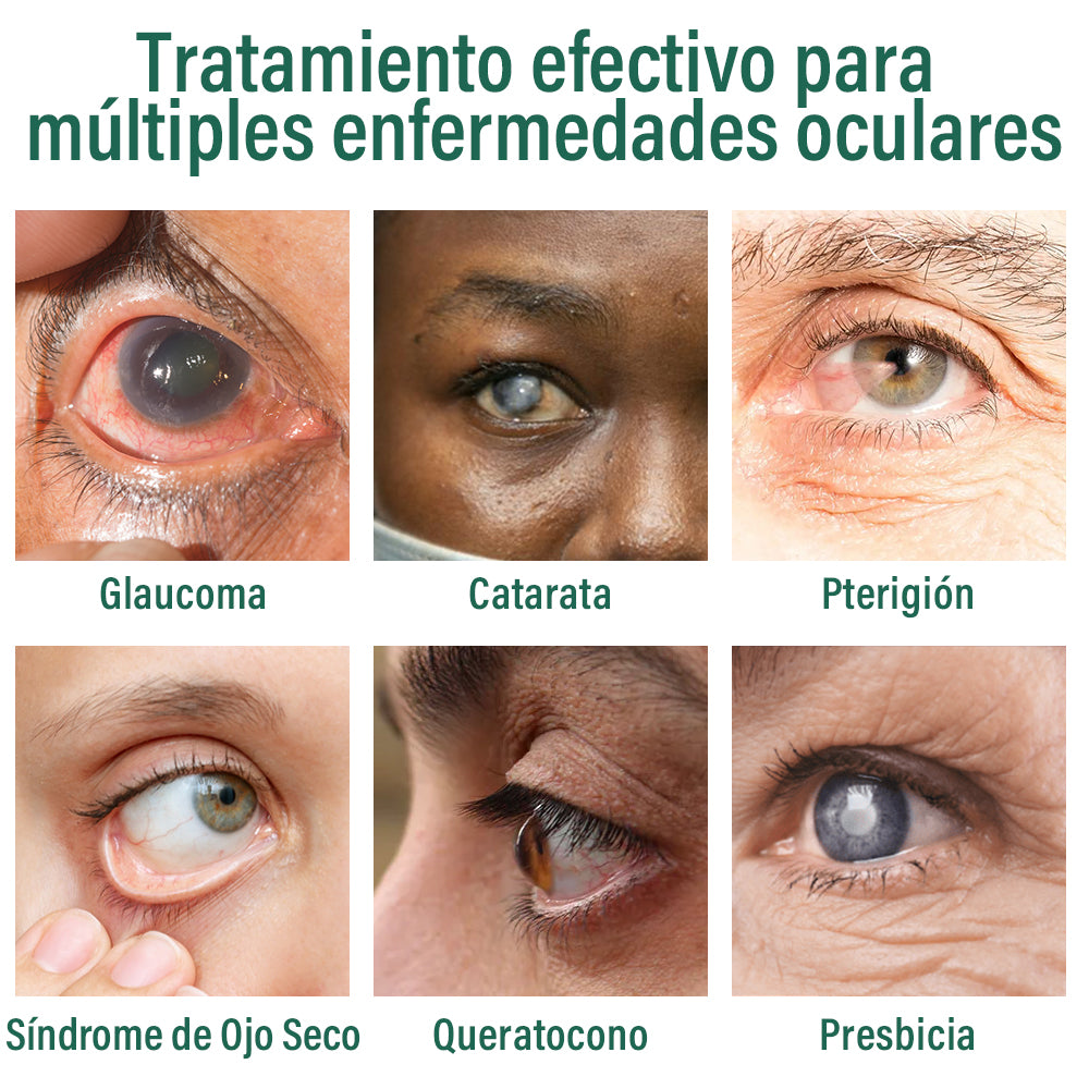 👩⚕️ Suero Nanodrop para Ojos Ourlyard® ✅Adecuado para presbicia, síndrome de ojo seco, glaucoma y cataratas
