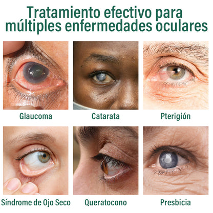 👩‍⚕️ Suero Nanodrop para Ojos Ourlyard® ✅Adecuado para presbicia, síndrome de ojo seco, glaucoma y cataratas